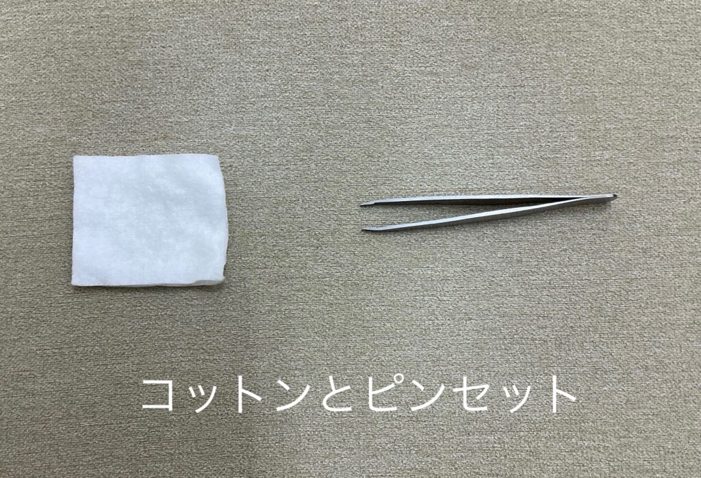 巻き爪の応急処置法