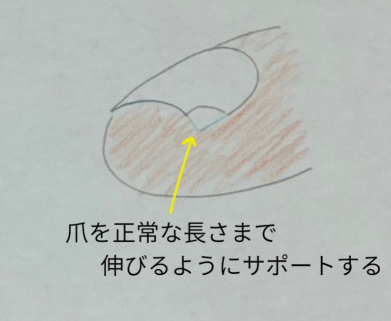 爪のトゲの処置